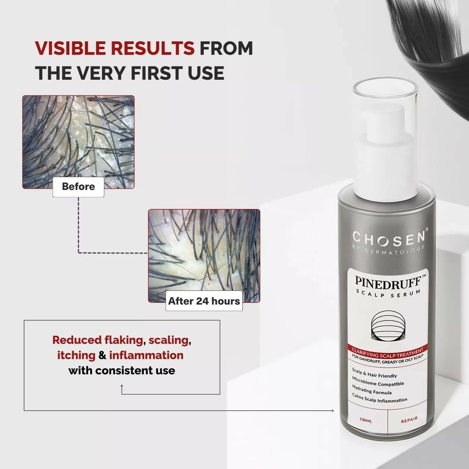 Chosen Pinedruff Scalp Serum Best Dandruff Control Treatment Solution With Pycnogenol