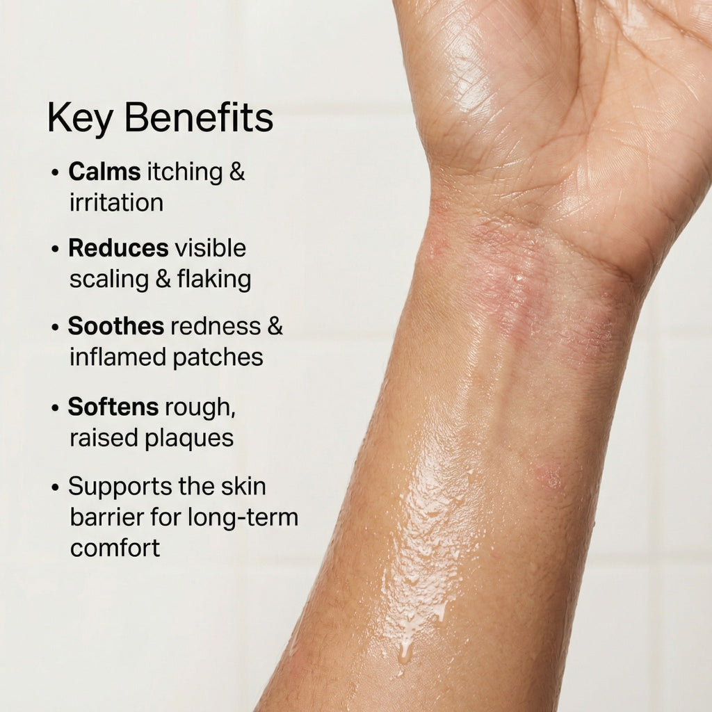 Vedicderm Psoriasis Cream